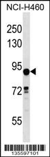 DLEC1 Antibody