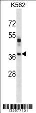 VSX1 Antibody