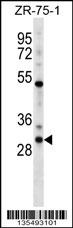 HOXD1 Antibody