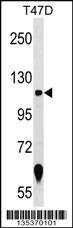 ZNF217 Antibody