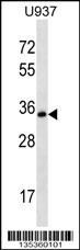 STX12 Antibody