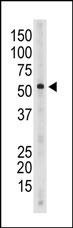 SIGLEC6 Antibody