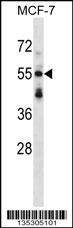 SNTB2 Antibody