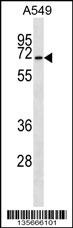 CSRNP3 Antibody