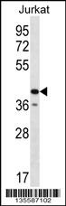 GORASP2 Antibody