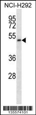 PIGT Antibody