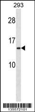 RPS20 Antibody