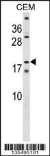 SSX4 Antibody