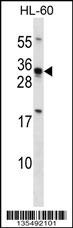 HOXB8 Antibody