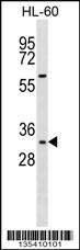 Hoxb13 Antibody