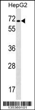 CACNB1 Antibody