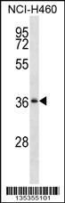 SERPINB1 Antibody