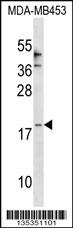 CCL25 Antibody