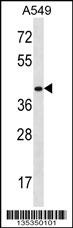 HOXD11 Antibody