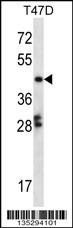 GABPB1 Antibody
