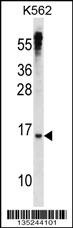 MXD3 Antibody