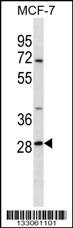 SRPRB Antibody