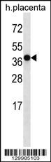 OR5H2 Antibody