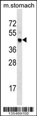 Cdk20 Antibody