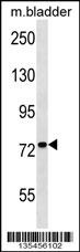 Adck3 Antibody