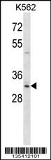 Hoxb8 Antibody