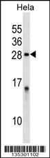PPP1R2 Antibody