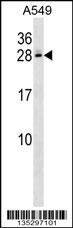 C4BPB Antibody