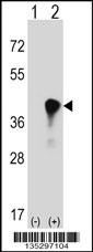 C4BPB Antibody