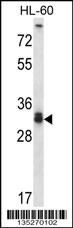 STX6 Antibody