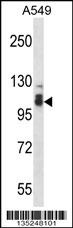 SMEK2 Antibody