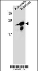 RAB25 Antibody