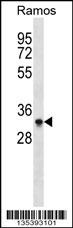 Aurkb Antibody