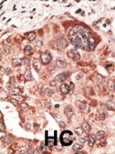 Recoverin Antibody