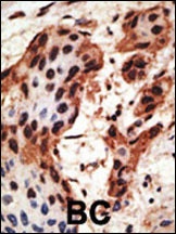 GJB6 Antibody