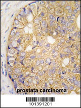 GJB6 Antibody