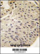 GJB5 Antibody