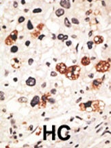 Connexin 31 Antibody