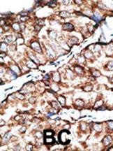 DKKL1 Antibody