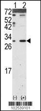 DKK2 Antibody