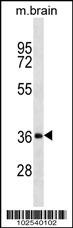 DKK2 Antibody