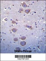 Tlr8 Antibody
