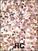 Tlr2 Antibody