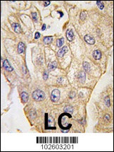 Tlr2 Antibody