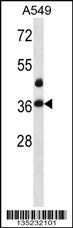 LASP1 Antibody