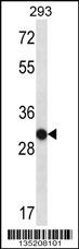 OR4K14 Antibody