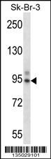 TBX3 Antibody