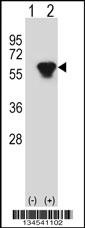 PRKAR2B Antibody