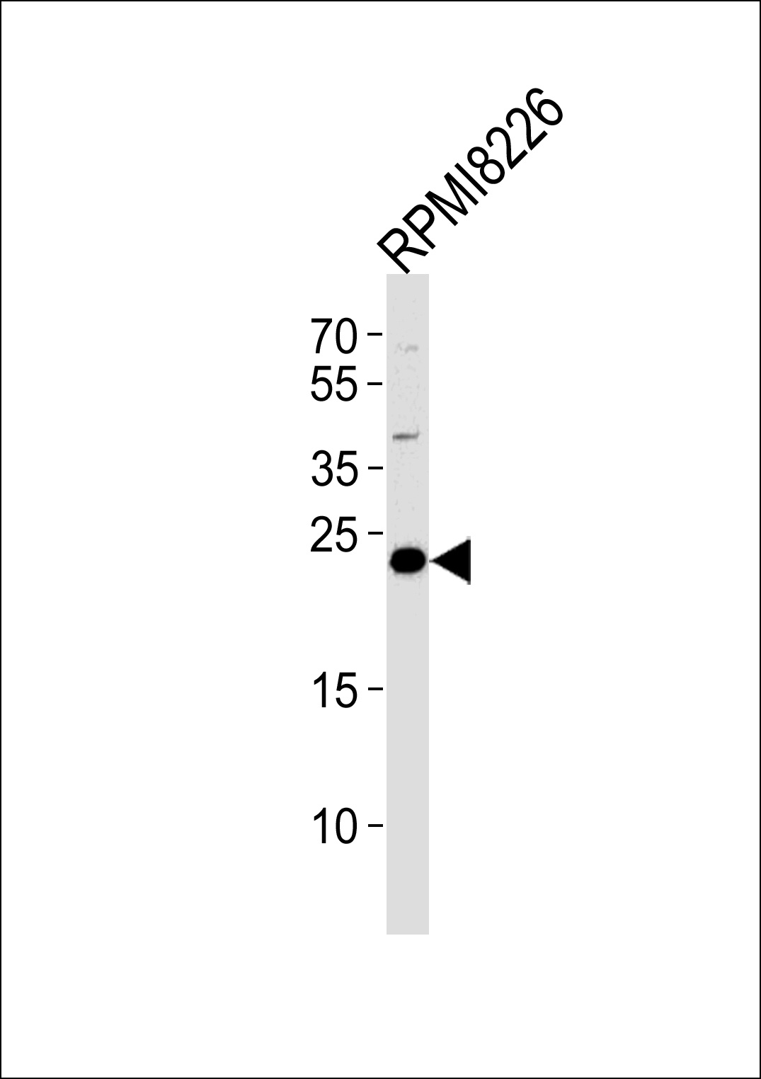 CD3G Antibody