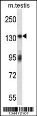 Erbb2 Antibody