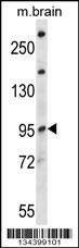 NEDD4L Antibody